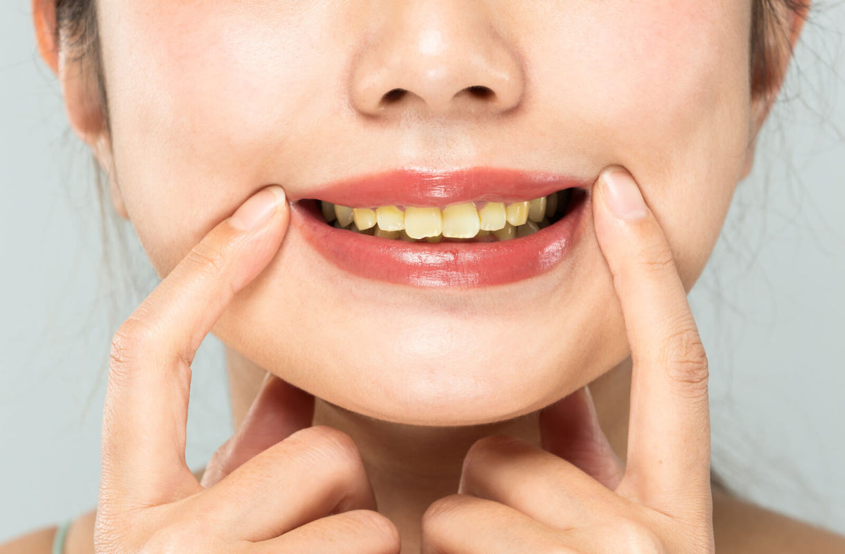 How Do I Get Rid of Yellow Teeth ASAP?