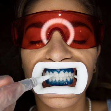a women on a teeth whitening treatment